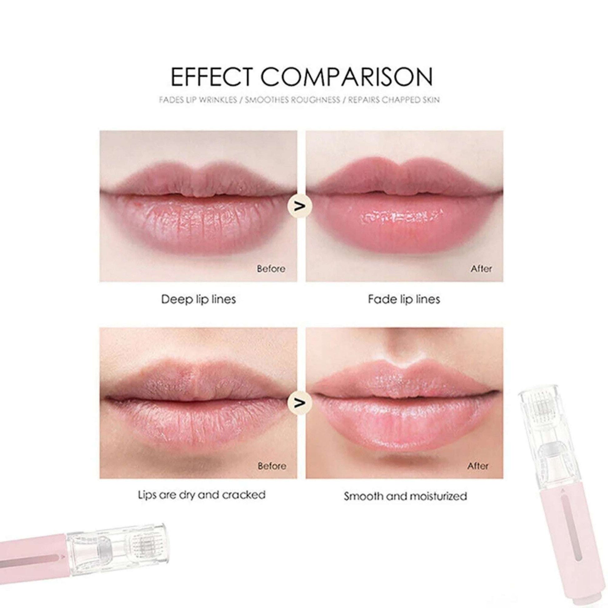 3 In 1 Lip Care Roller Needle Roller Lip Roller Beard Growth Roller Beard Hair Growth Roller Beard Treatment Serum Applicant - globaltradeleader