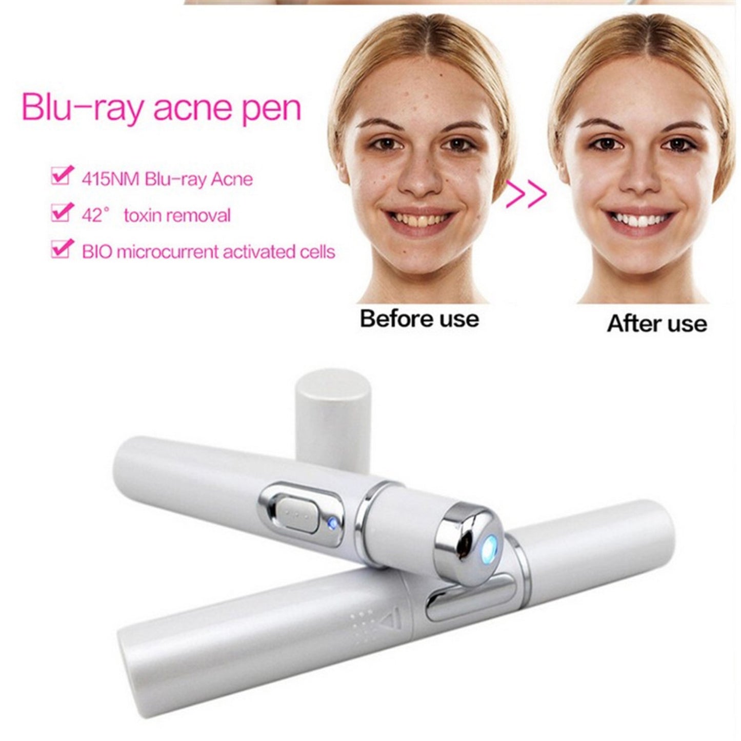 MOQ1 Wrinkle Blemish Pore Acne Scar Remover Pen