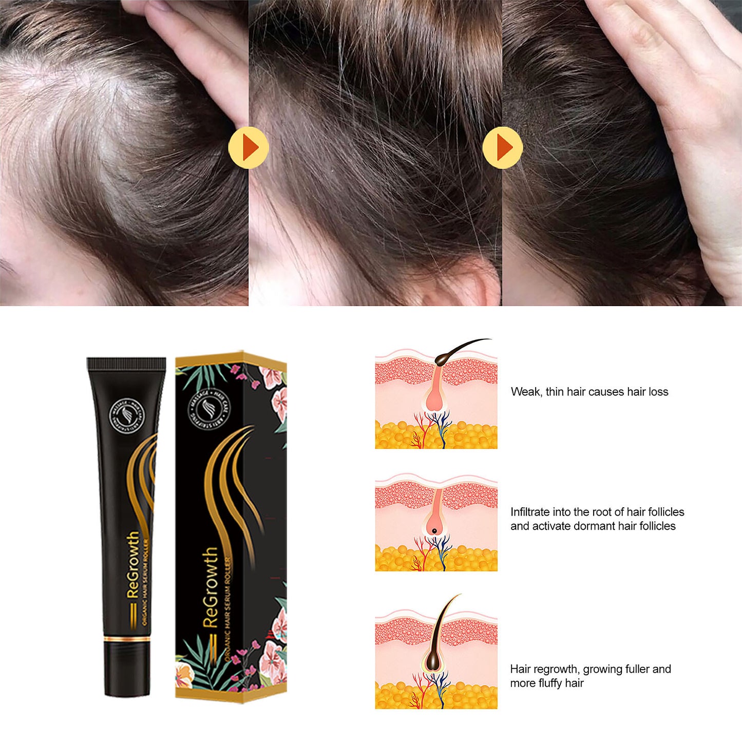 Regrowth Organic Hair Serum Roller Set Hair Care Anti Stripping