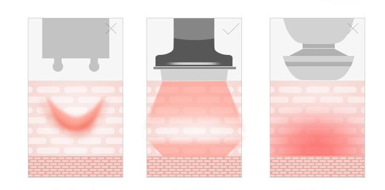 Micro-current Electroporation Into Beauty Equipment