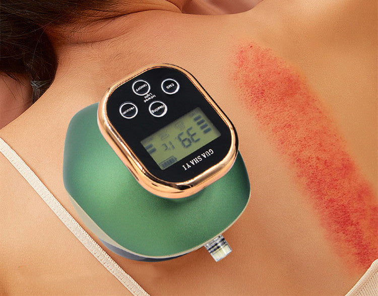 Electric Gas Tank Cupping Device