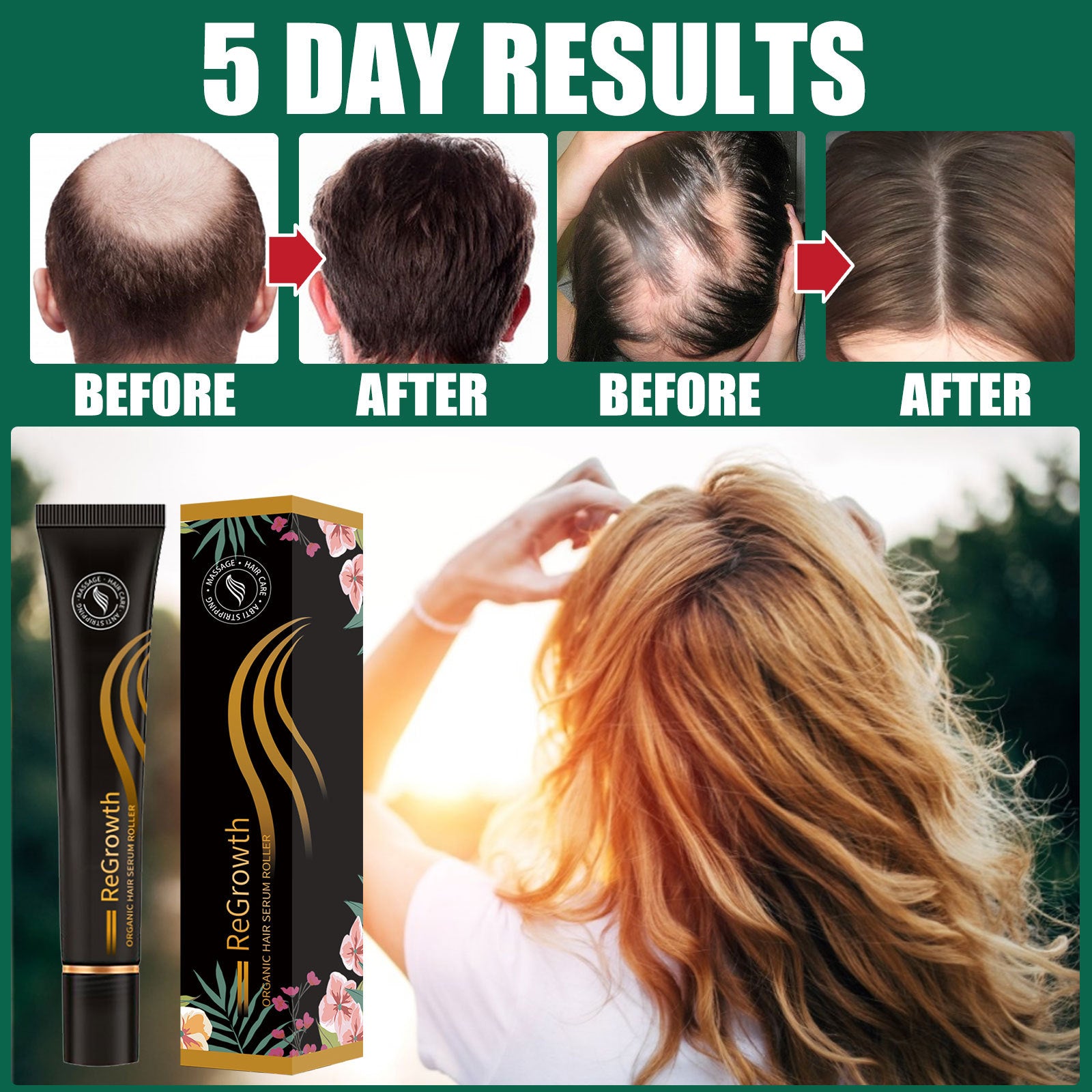 Regrowth Organic Hair Serum Roller Set Hair Care Anti Stripping